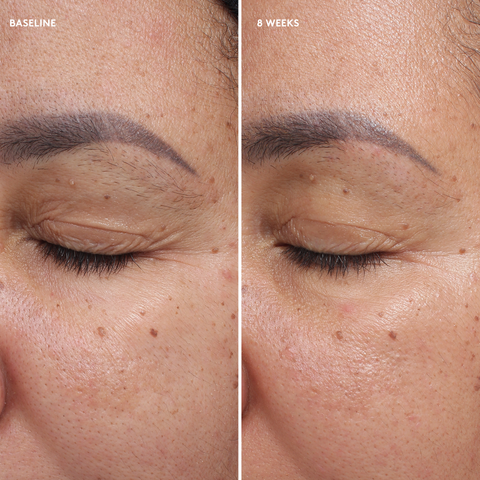 Firm and Repair Cream - Зміцнювальний і відновлювальний крем для повік (Total Eye®)