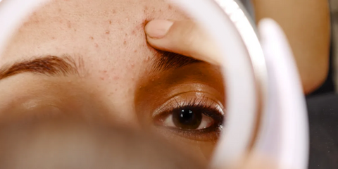 Péče o citlivou pleť: jak se o ni správně starat